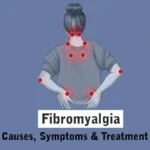 Fibromyalgia