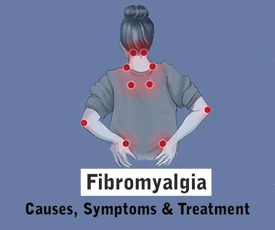 Fibromyalgia